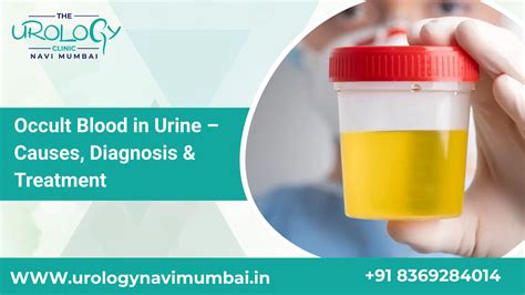 Occult Blood in Urine: Causes, Diagnosis & Best Treatments - Dr ninad ...