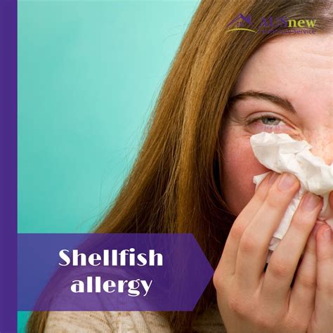 Best 13 Shellfish allergy – Symptoms and causes – Artofit