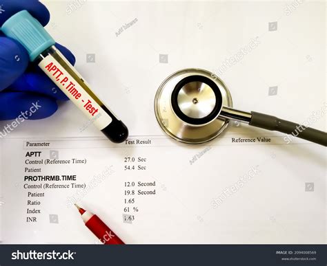 816 Blood Coagulation Patient Images, Stock Photos & Vectors | Shutterstock