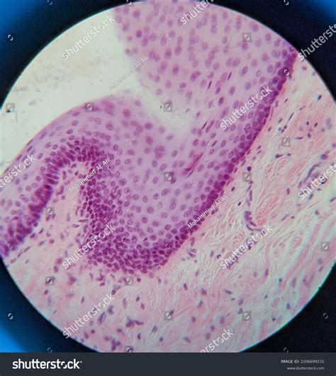 Stratified Squamous Epithelium Non Keratinized Esophagus