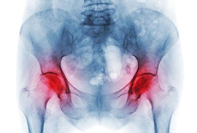 Dr Sarang patki - Arthroscopy & Joint Replacement in panvel,Navi Mumbai