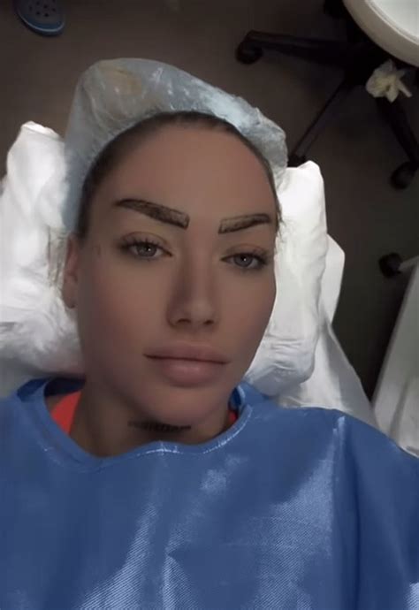 Splitska influencerica pokazala lice prije svih operacija: "Kao da bi itko htio biti sa mnom ...