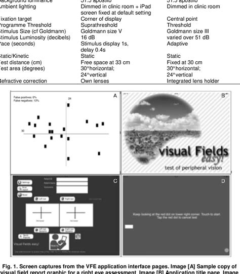 Image result for Check Visual Fields
