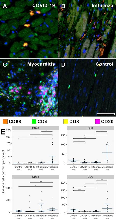 Research sheds light on cardiac pathology mechanisms of COVID-19