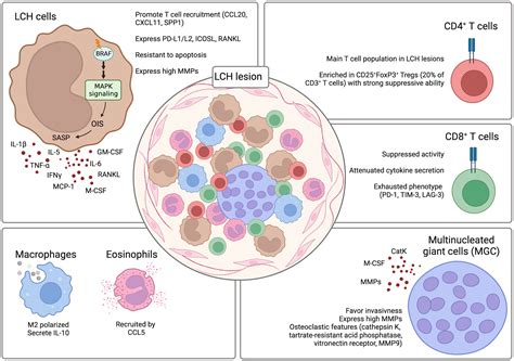 Cancer Langerhans Histiocytosis