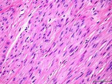 Spindle Shape 的图像结果