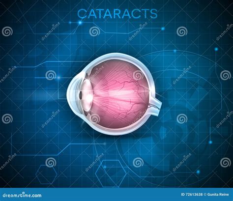 Vision Disorder 的图像结果