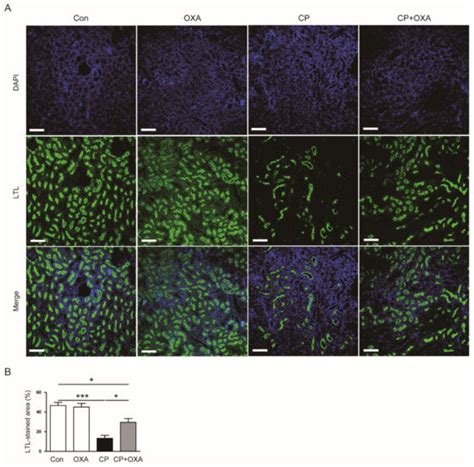 Protective Effects of Orexin A in a Murine Model of Cisplatin-Induced ...