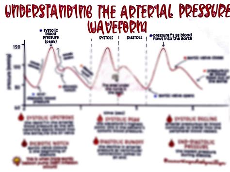 Abnormal Arterial Waveforms