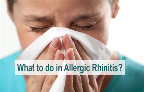 Combatting allergic rhinitis-Why prefer Fexofenadine - Montelukast over ...