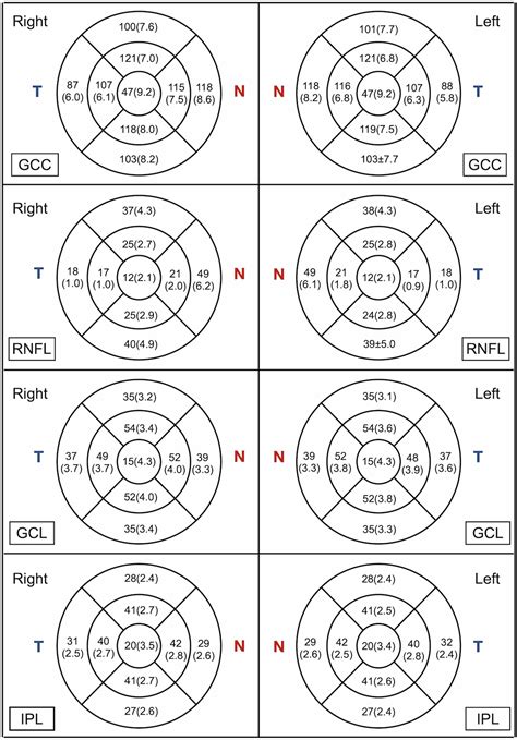 Establishing normal interocular symmetry range for macular optical coherence tomography ...