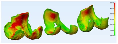 CT- and MRI-Based 3D Reconstruction of Knee Joint to Assess Cartilage ...