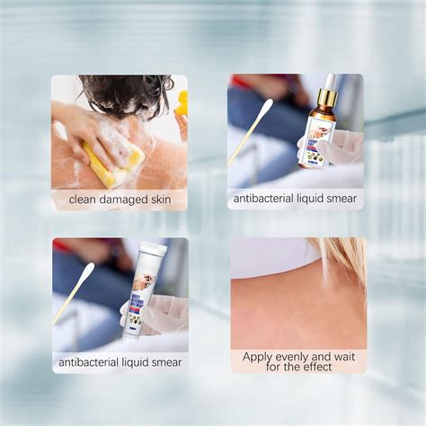 Juego de removedor de verrugas extracto natural suave y seguro removedor de verrugas portátil ...