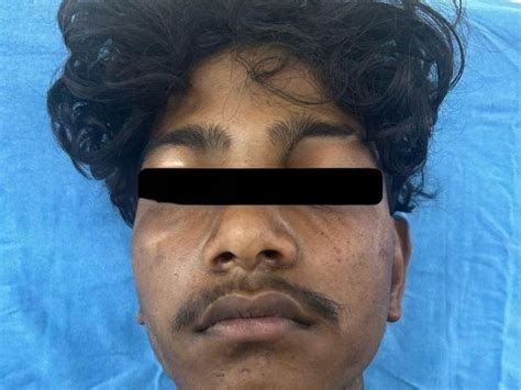 A knife measuring more than 5 inches was surgically removed from the ...