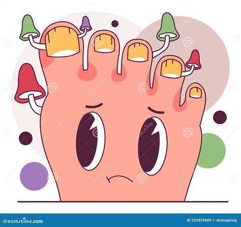 Onicomicosis. Infección Por Hongos En Uñas Y Pies. Hongos En La Piel ...