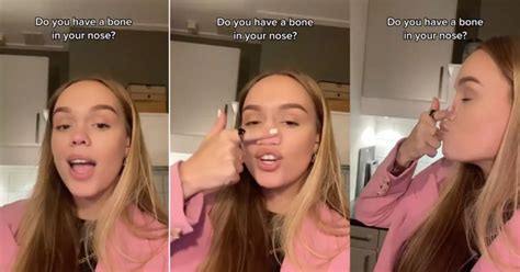 Woman Born Without Nose Bone Can Flatten It