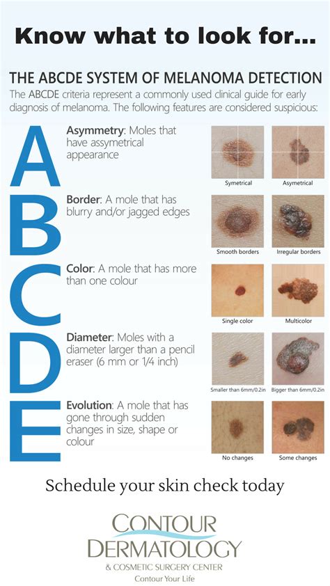 Acronym For Skin Cancer