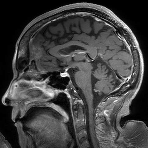 It is not your eyes - Survey of Ophthalmology