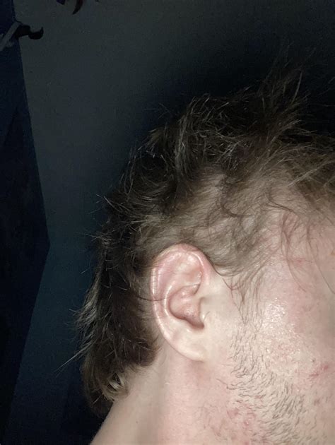 Why Is My Hair Thinning All Over My Head at Bruce Conti blog