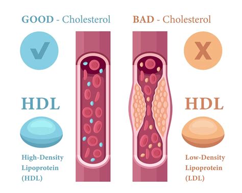 Image result for HDL Components Code