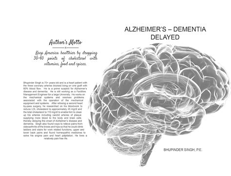 Alzheimer's - Dementia Delayed eBook : Singh, Bhupinder: Amazon.in ...