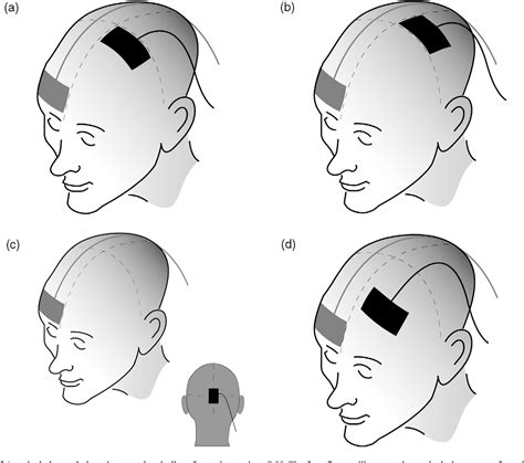 Process Bone 的图像结果