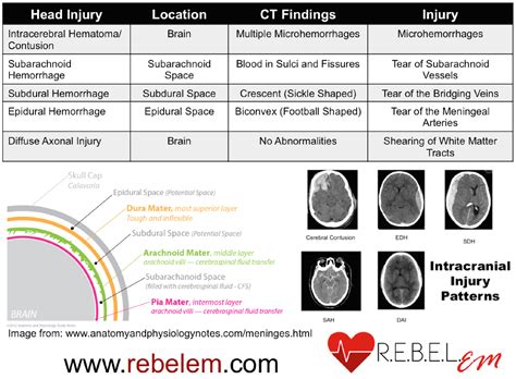 Types Of Cranial Hemorrhage AI Interpretation Of Intracranial