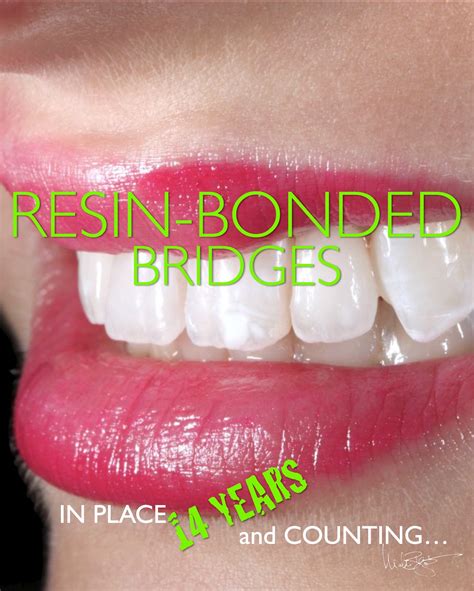 Prof. Dr. Markus B. Blatz | DENTAL PHOTOGRAPHY FUNDAMENTALS „How to ...