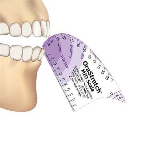 Measurement Of Degree Of Trismus