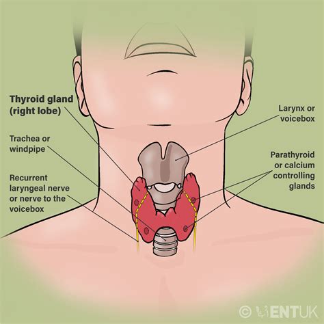 Thyroid lumps and thyroid surgery - Diagnostic hemithyroidectomy | ENT UK