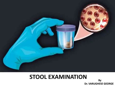 Image result for Stool Sample Test