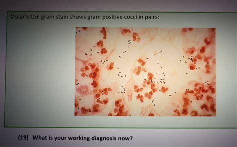 Oscar's CSF gram stain shows gram positive | StudyX