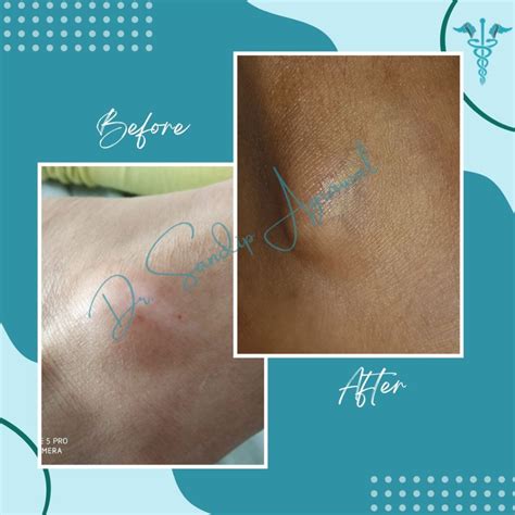 Treatment Gallery - Dr. Sandip Agrawal