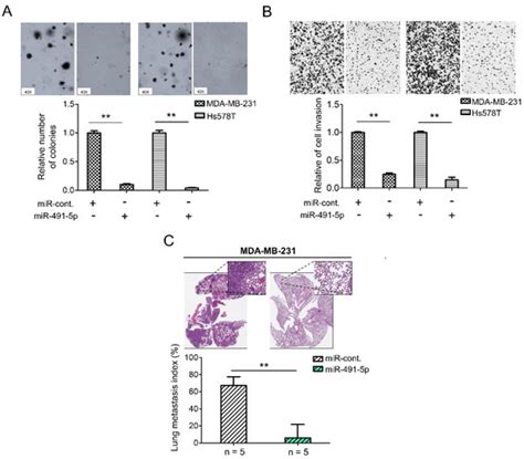 Identification of the Novel Tumor Suppressor Role of FOCAD/miR-491-5p ...