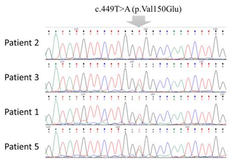 Identification and Characterization of BTD Gene Mutations in Jordanian ...
