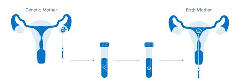 Reciprocal IVF - Procreate Fertility Center of Virginia | Infertility ...
