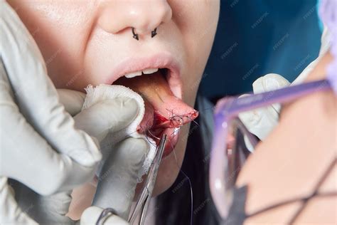 Premium Photo | Tongue splitting cutting the tongue one type of modification of the human body ...