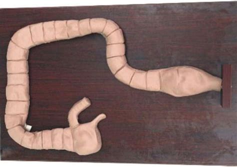 Medical Gift Colonoscopy Examination Modelintestine Model Human ...