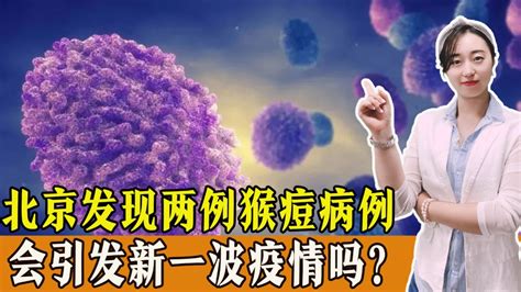 北京发现两例猴痘病例，传染性如何，会引发新一波疫情吗？_腾讯视频