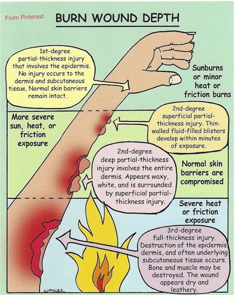 4th Degree Burn Diagram