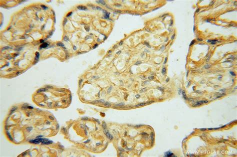 KPTN antibody (16094-1-AP) | Proteintech
