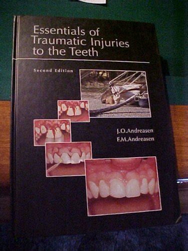 Buy Essentials of Traumatic Injuries to the Teeth: A Step-by-step ...