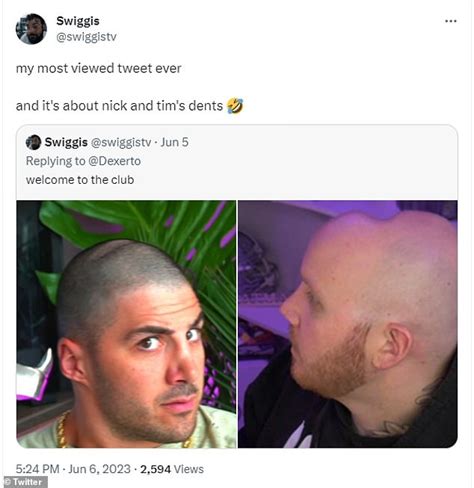 Do YOU have 'gamer head'? Twitch user finds indent on his cranium from ...