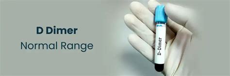 Image result for D-dimer Normal Lab Range