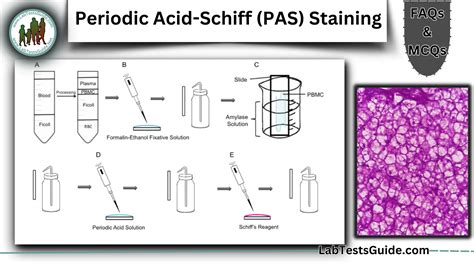 Periodic Acid-Schiff (PAS) Staining 50 FAQs and 30 MCQs