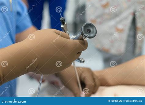 A Team of Urologist Doctors Performing a Cystoscopy Using a Cystoscope. in a Sterile Operating ...