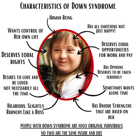 Extreme Cases Of Down Syndrome: Key Differences You Should Know