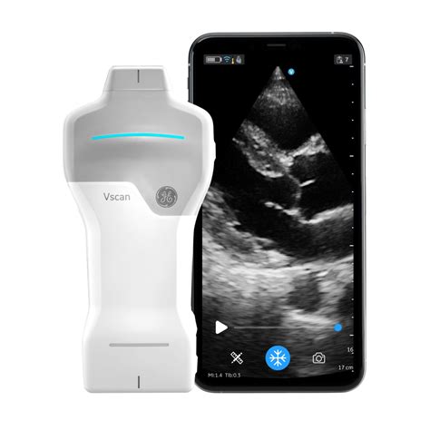 Shop Vscan Air™ SL Handheld Ultrasound | GE HealthCare