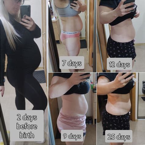 Post partum belly progress - first months | Postpartum belly, Strech ...