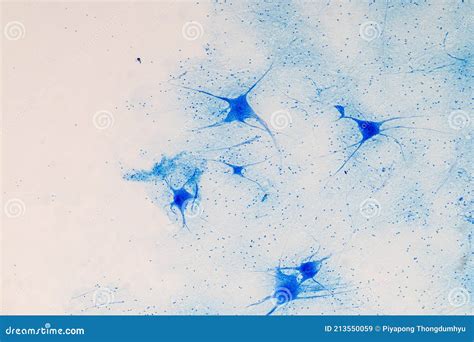 Motor Neuron Under The Microscope. Stock Photo | CartoonDealer.com ...